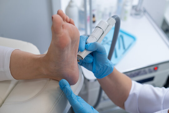The podologist treats the feet using electric device machine. Patient on medical pedicure procedure, visiting podiatrist. Peeling feet. Foot treatment in SPA salon.Podiatry clinic