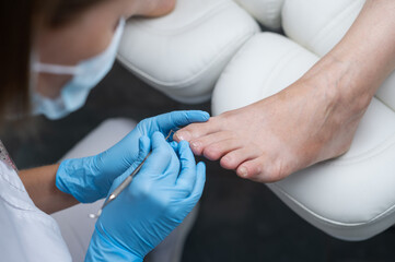 The podologist cleans the patient's nail using a curette tool. Patient on medical pedicure procedure, visiting podiatrist. Peeling feet. Foot treatment in SPA salon.Podiatry clinic