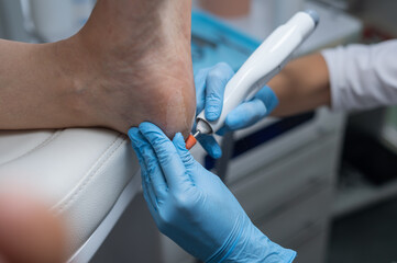 The podologist treats the feet using electric device machine. Patient on medical pedicure...