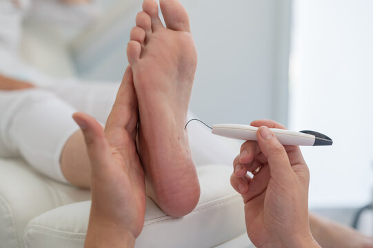 A podologist checks the diabetic  foot  with a Diabetic Foot Probe. Patient on medical pedicure procedure, visiting podiatrist. Peeling feet. Foot treatment in SPA salon.Podiatry