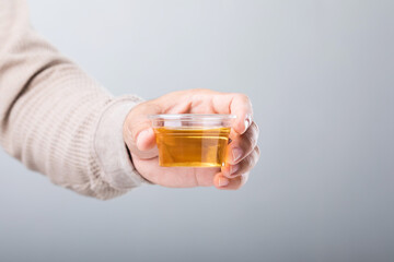 Man holds a clear plastic cup containing a urine sample, emphasizing how urine color can reveal important health insights. A reminder of the role of self-monitoring in maintaining wellness