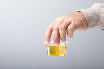 Man holds a clear plastic cup containing a urine sample, emphasizing how urine color can reveal...