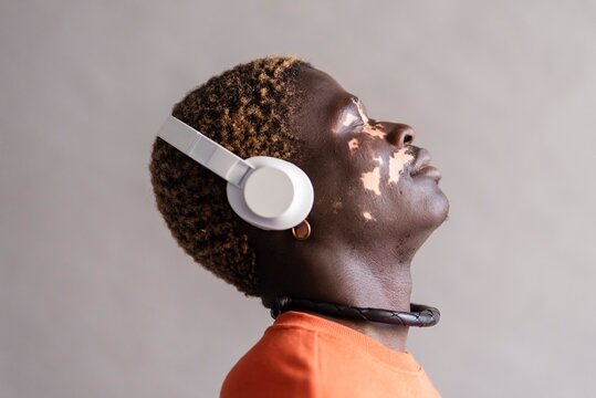 Side profile of a man with vitiligo wearing headphones and an orange sweatshirt, with his head tilted back and eyes closed