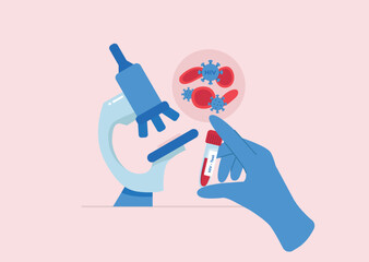 Doctor's hand in glove holds HIV test tube.
Examining infected blood with HIV virus under microscope in laboratory. Vector illustration in flat style.