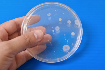 Colonies of bacteria growth on agar plate medium in laboratory.	