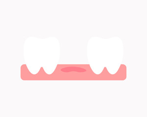 Loss teeth icon. Healthcare, dental, medicine, treatment, hygiene, oral care, gum concepts. Flat vector design isolated illustration.