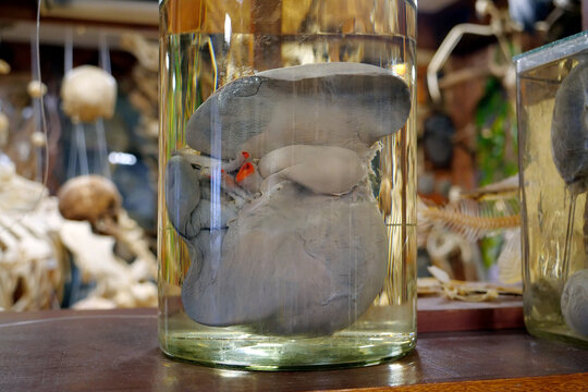 Human liver in glass flask. Major metabolic organ