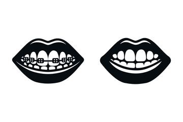 Teeth braces icon. smile with and without braces, Dental bracket system vector illustration. Tooth dentistry, isolated concept.