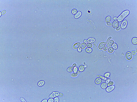 Microscopic View of Yeast Cells