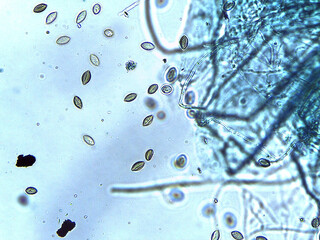Microscopic View of Spores and Microorganisms