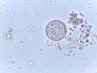 Microscopic View of Microorganisms in Fluid