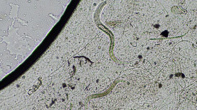 worms under the microscope in a laboratory