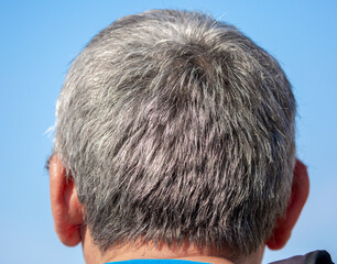 Obraz premium Gray hair on a man, back and side view, close up. Graying man with premature gray hair showing black gray roots of hair on head, transition to elderly old man, outdoor background.