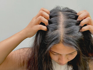 Women with hair loss dryness and frizziness