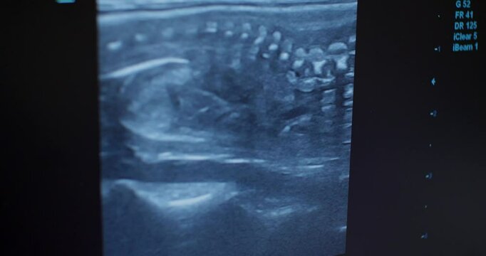 Ultrasound images show several unborn puppies moving around inside their mother's belly, demonstrating the development and life of these adorable dogs during pregnancy. Pregnant dog on ultrasound.