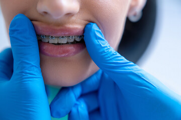 Unrecognizable woman having examination at dental office w