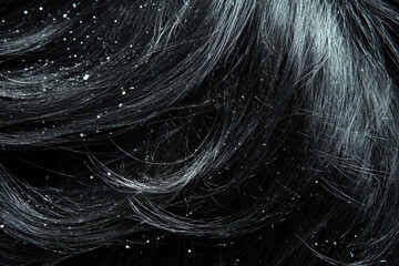 closeup view of black hair with dandruff flakes, hair and scalp health issue concept