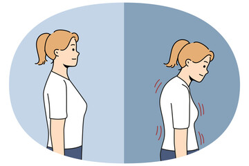 Stooped woman before and after correcting posture thanks to massage therapist or chiropractor helping to get rid of scoliosis. Girl with bad posture due to lordosis and kyphosis or spinal defect