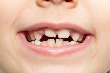 close up of a child's mouth