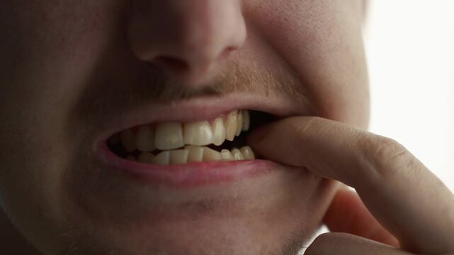 A man shows his teeth.
The patient's teeth are covered.
A man shows his lower row of teeth.
Uneven teeth.
Dentist, teeth, pain, mouth