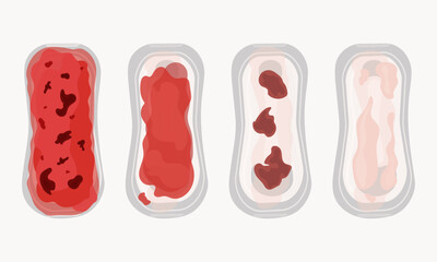 Vaginal postpartum bleeding - lochia. Lochia intensity scale on a set of sanitary pads. Isolates on a white background. Feminine hygiene. Women's health. Flat. Vector illustration.