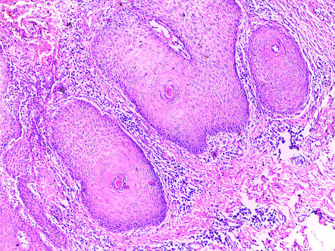 Microscopic View of Skin Tissue with Hair Follicles