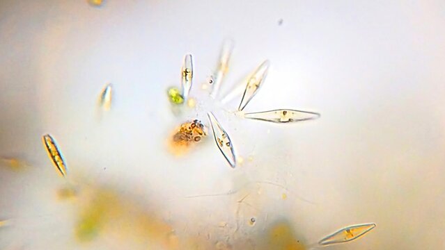 A type of unicellular algae in the phylum Chlorophyta called Closterium has a crescent-shaped form, translucent, and smooth surface. It is found in freshwater and can be observed under a microscope.