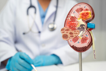Chronic kidney disease, doctor with model for treatment urinary system, urology, Estimated...