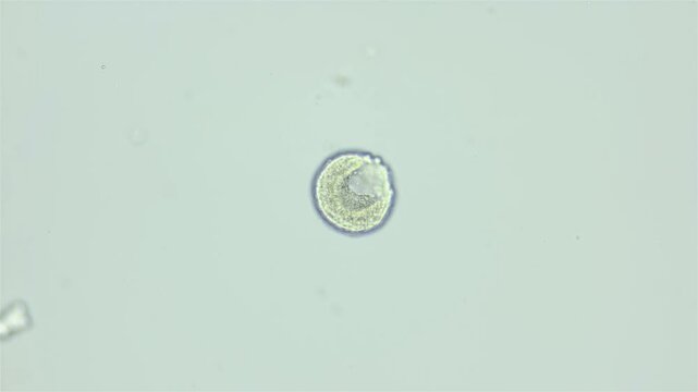 Larva sea urchin Strongylocentrotus pallidus under microscope, phylum Echinodermata. Blastula stage, locking half. White sea