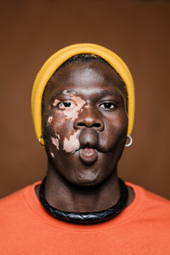 portrait of a young man with vitiligo wearing a yellow beanie and an orange shirt making a humorous fish face against a brown background showcasing his unique skin pattern and playful expression.
