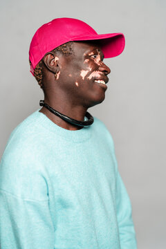 Black man with vitiligo wearing a pink cap and turquoise sweater shown in side profile, smiling gently and looking away against a neutral gray background, showcasing a calm and confident demeanor.