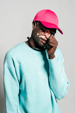 A young man with vitiligo dressed in a turquoise sweater and pink cap smiles with his hand near his face, showing a playful and shy expression against a simple gray background.