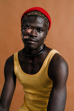 Black man with vitiligo wearing a yellow tank top and a red beanie sits against a brown background, looking into the camera with a calm and contemplative expression, showcasing individuality and style
