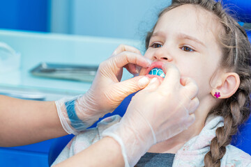 Dentist putting orthodontic trainer for little girl sitting on chair in Dentist office.