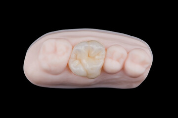 High-quality single dental crown with naturally morphology made of multilayer zirconia for upper jaw © gorynvd