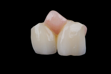 Two dental crowns wit artificial gum made of zirconium for fixation to frontal teeth of upper jaw.