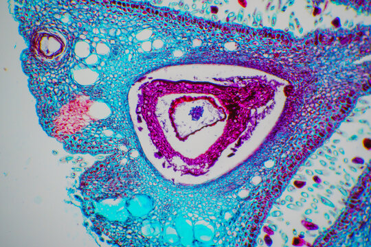 Evodia rutaecarpa fruit micgograph