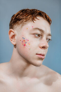 Handsome guy with acne