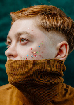 An unusual portrait of a guy with pimples and acne