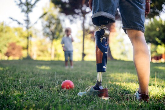 Person with Prosthetic Leg Playing Outdoors with Child