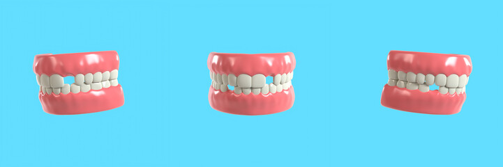 Set of Stylized Jaw with Broken Teeth 3D Illustration for Dental Health Concept