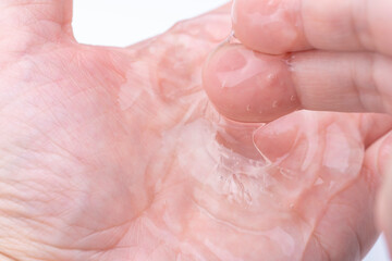 手のひらにのせた透明なジェルのクローズアップ