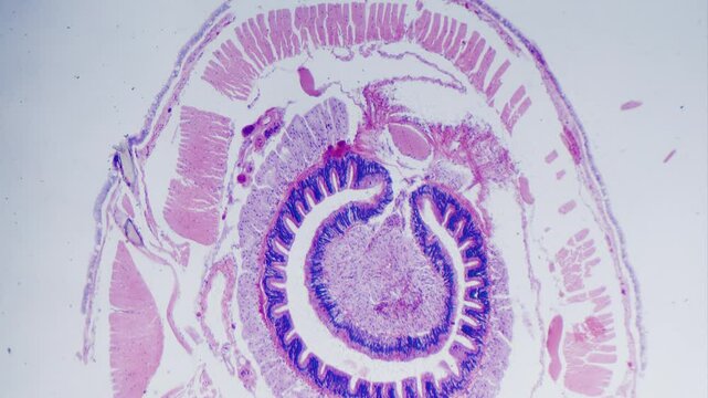 Earthworm transverse section under microscope bright field view, stained sample.