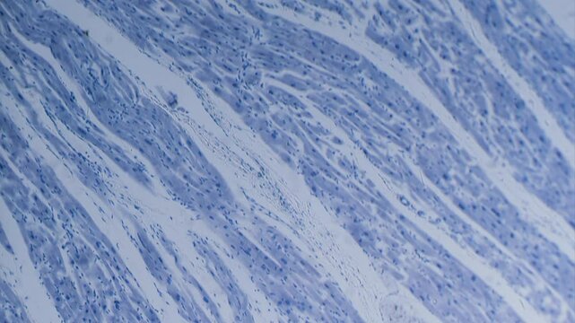 Cardiac muscle section, stained, view in microscope bright field