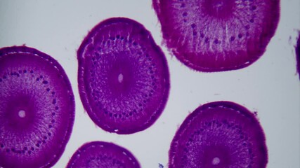 Ascaris parasitic worm cross section under microscope bright field view