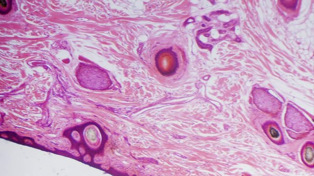 Stained skin section with hair follicle microscope view