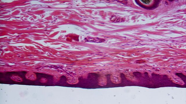 Stained skin section with hair follicle microscope view
