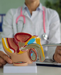 Doctors counseling patients with prostate cancer and using a penis model to show patients with...