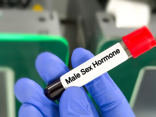 Blood sample for Male sex hormone test