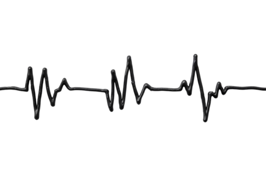 ekg heart beat